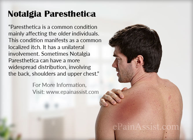 Notalgia paresthetica - Huidarts.com