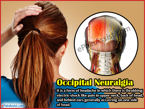 Occipital Neuralgia Treatment Symptoms Causes Diagnosis Occipital Neuralgia Treatment Symptoms Causes Diagnosis
