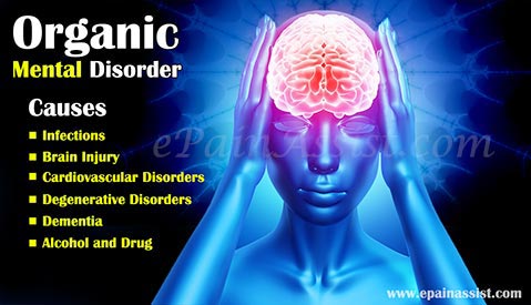 Causes of Organic Mental Disorder (OMD) milf image Causes of Organic Mental Disorder (OMD)