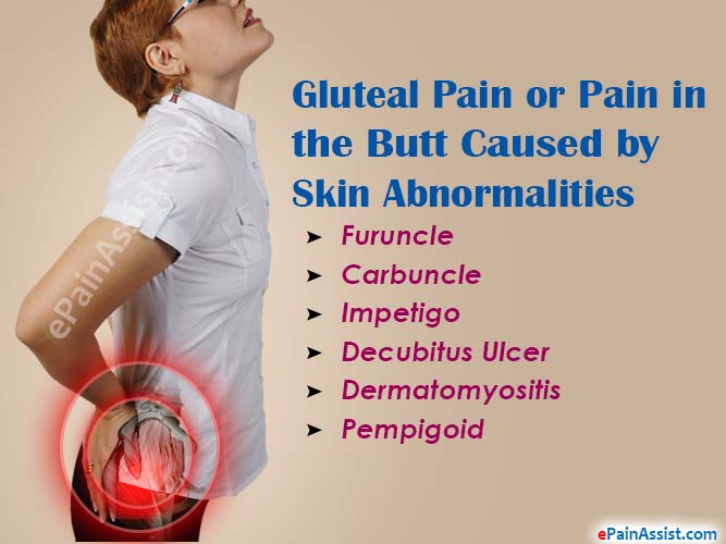 Gluteal Pain or Pain in the Butt Caused by Skin Abnormalities or Diseases