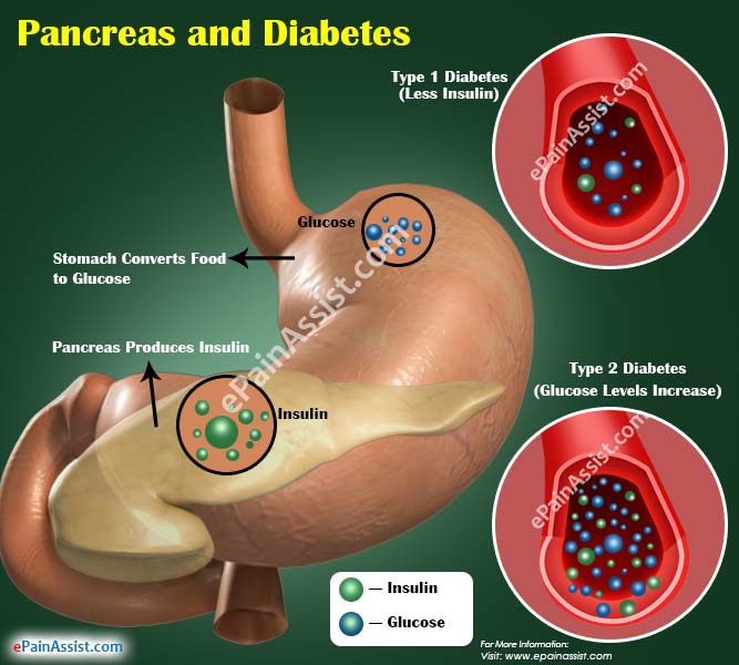 Pancreas and Diabetes