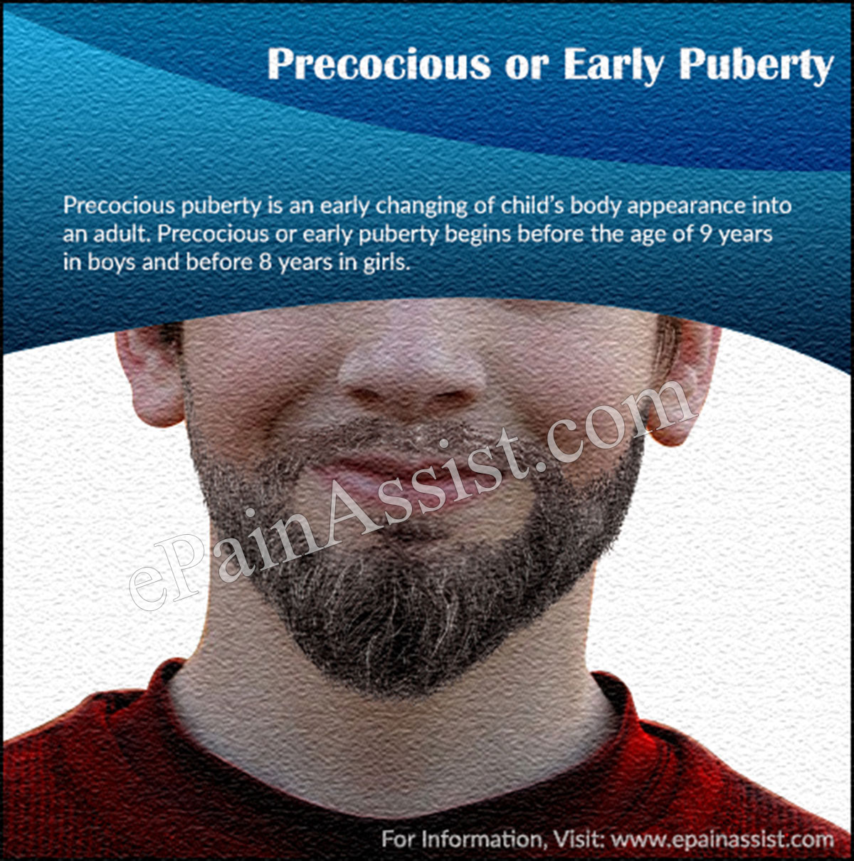 Precocious or Early Puberty Precocious or Early Puberty