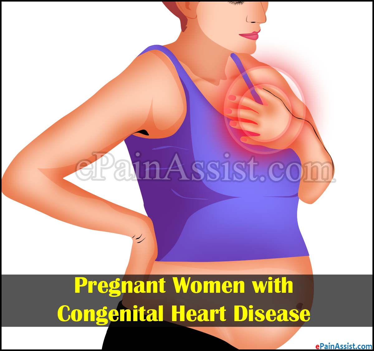 Pregnant Women with Congenital Heart Disease Pregnant Women with Congenital Heart Disease