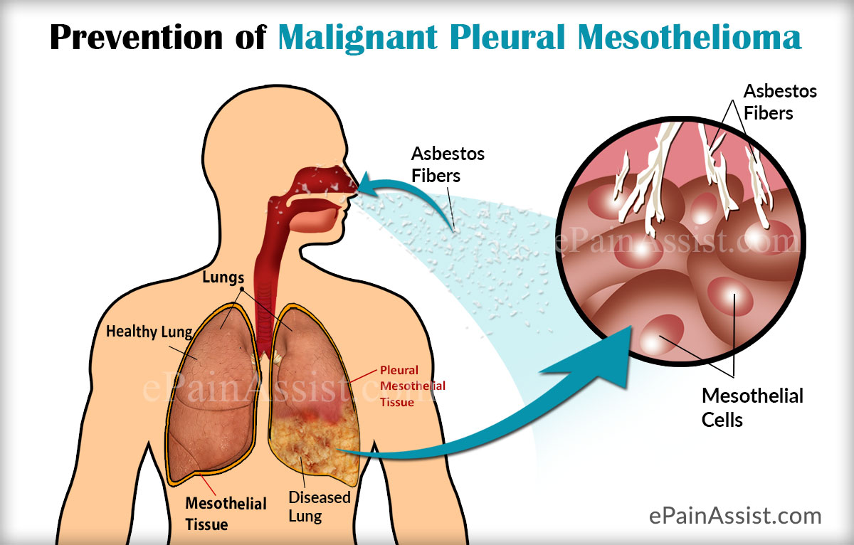 is there a blood test for mesothelioma