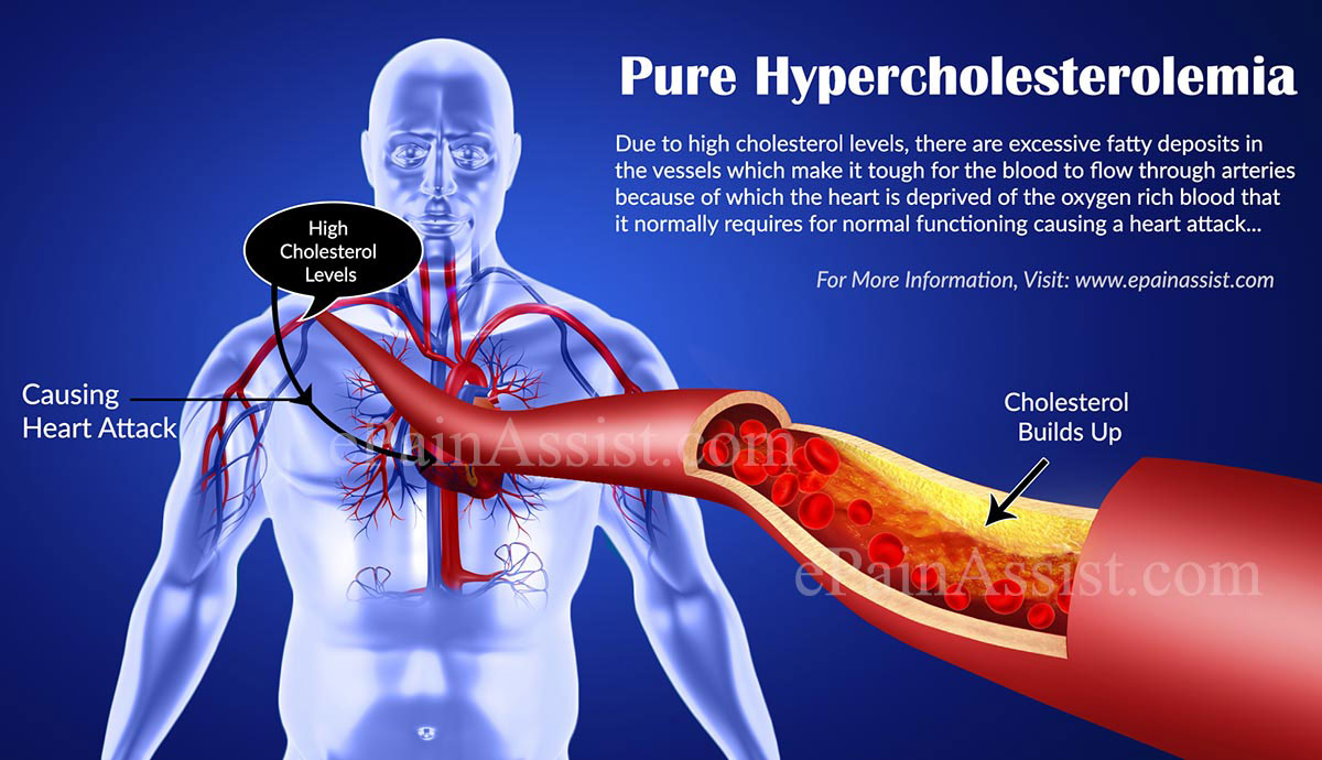 Pure Hypercholesterolemia Pure Hypercholesterolemia