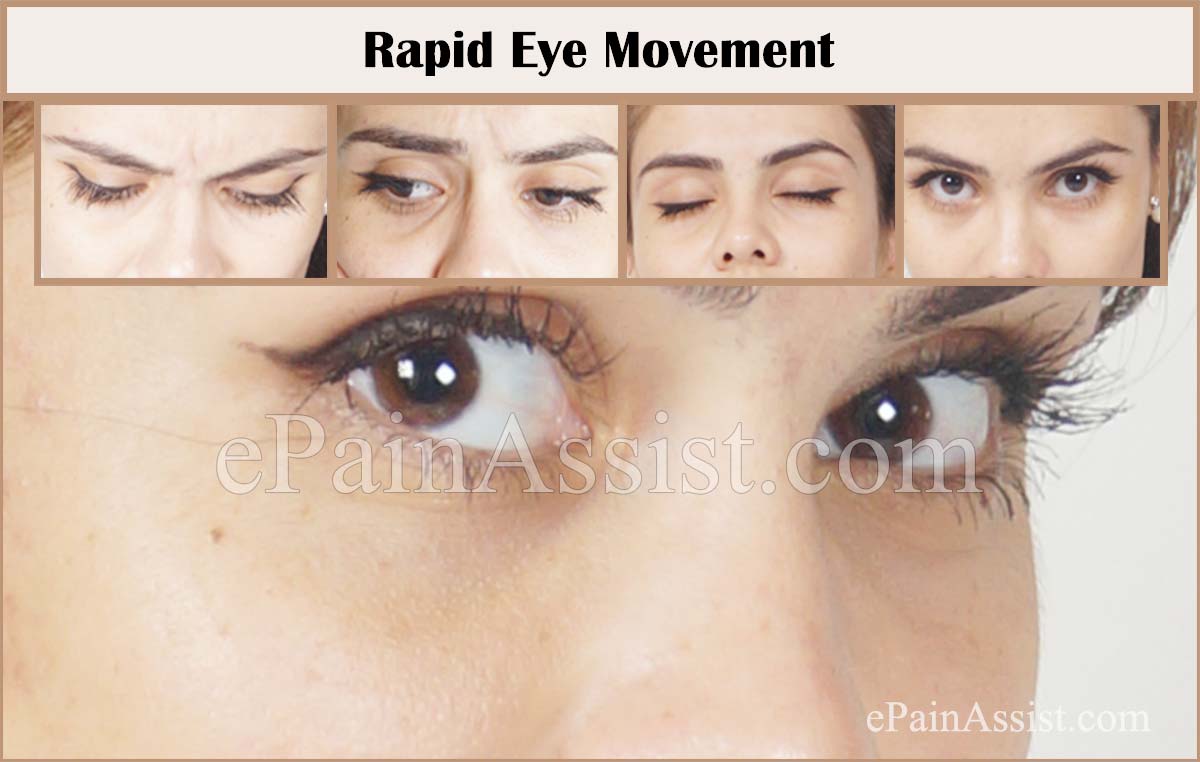 Rapid Eye Movement (REM) Sleep Behavior Disorder Rapid Eye Movement (REM) Sleep Behavior Disorder