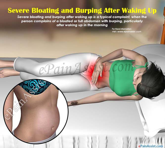 Severe Bloating and Burping After Waking Up