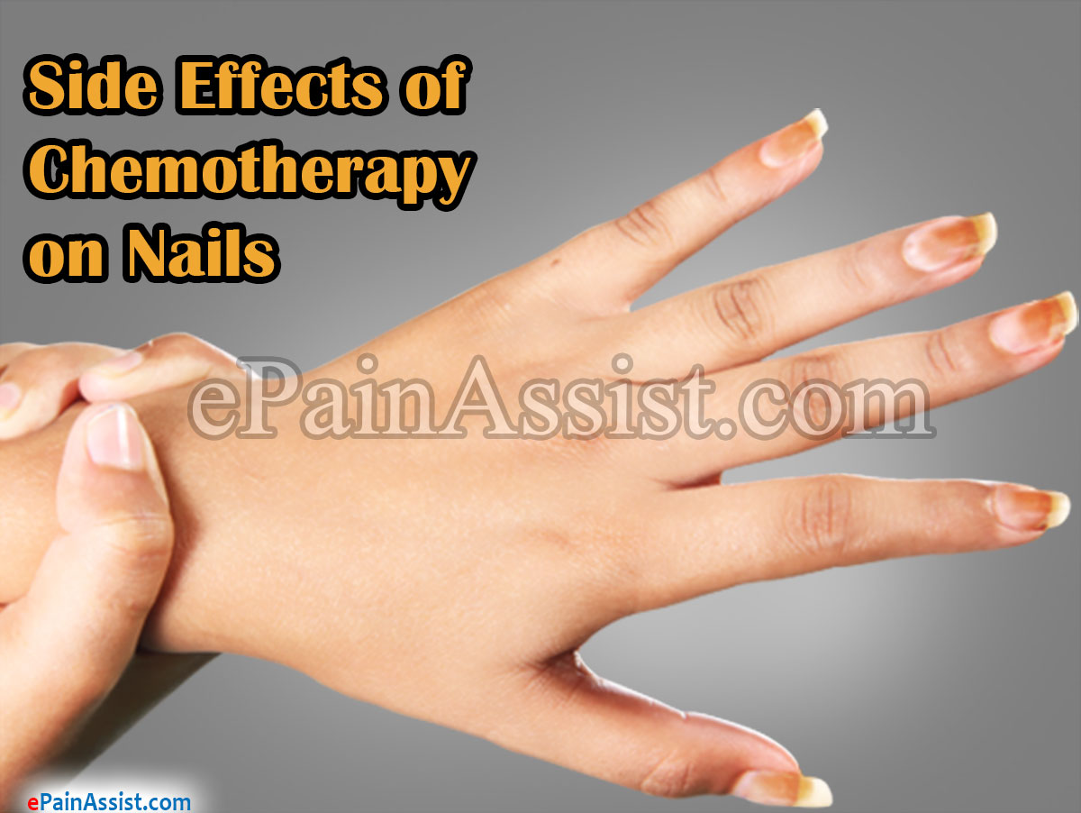 Side Effects of Chemotherapy on Nails