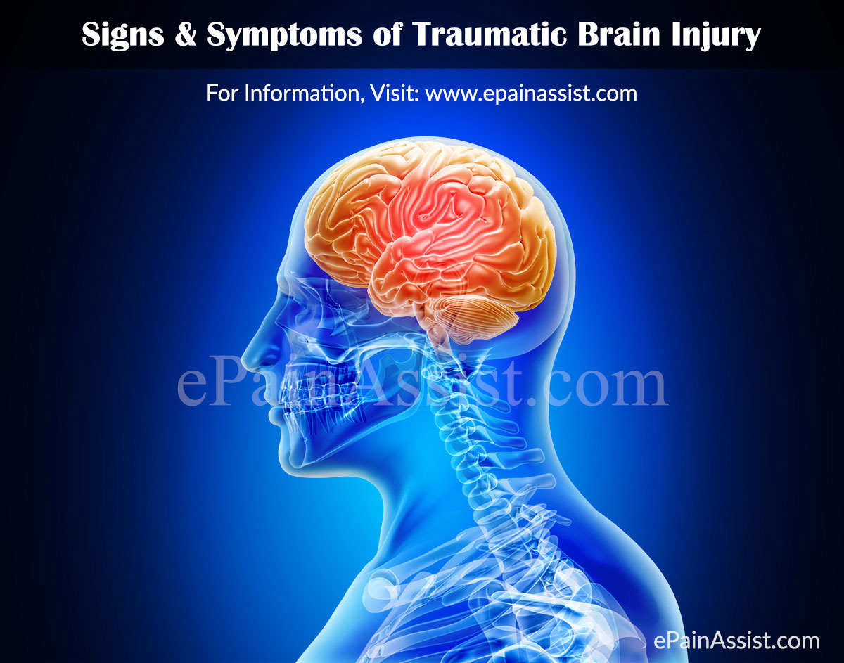 Signs & Symptoms of Traumatic Brain Injury (TBI) or Intracranial Injury Signs & Symptoms of Traumatic Brain Injury (TBI) or Intracranial Injury