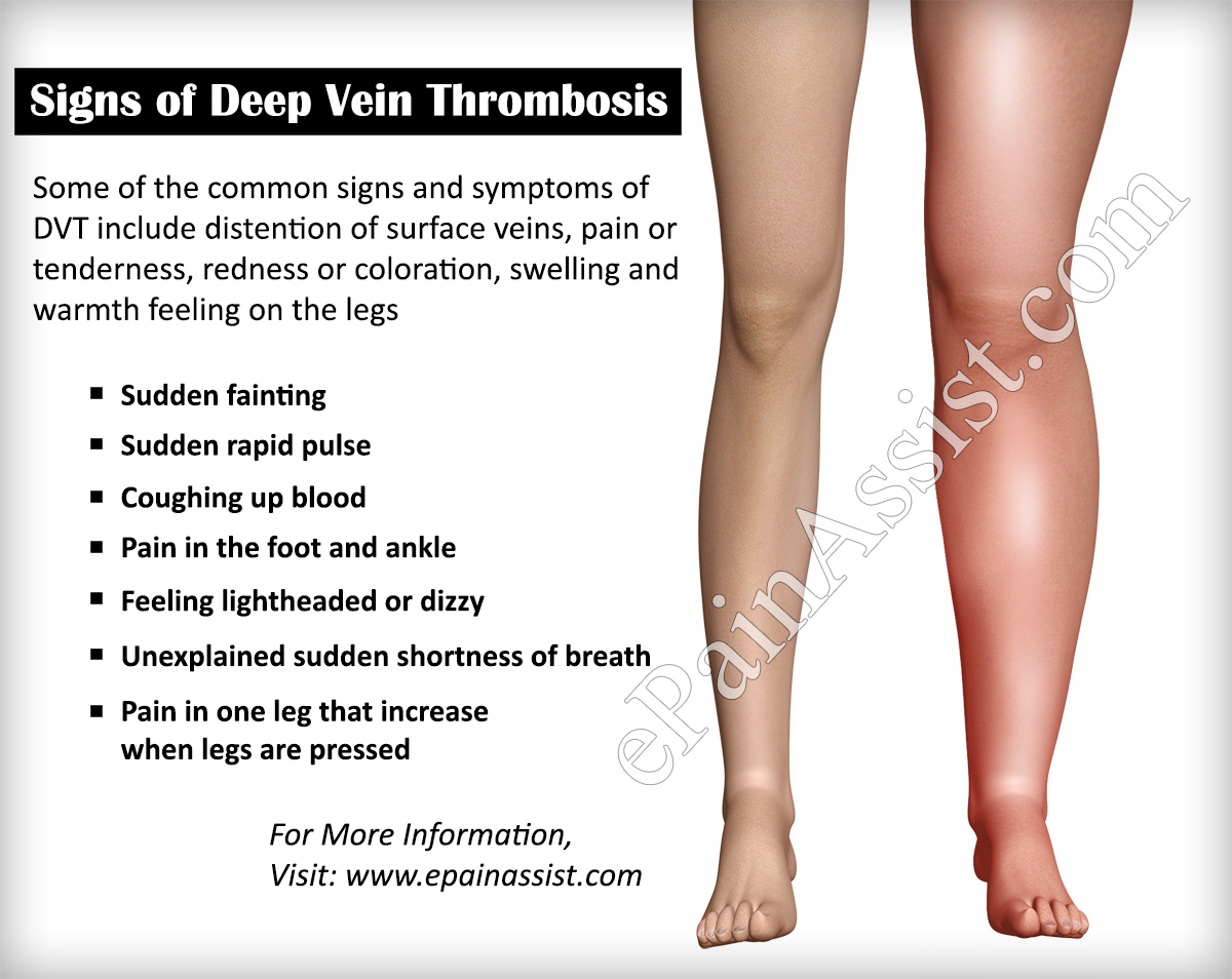 What are some causes of joint pain and blood clots?