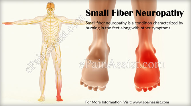 Small Fiber Neuropathy