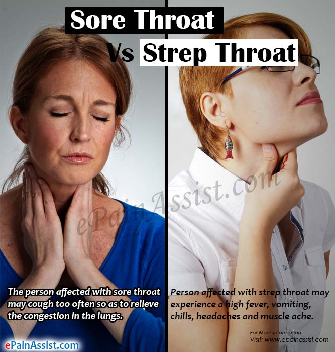 Sore Throat Vs Strep Throat