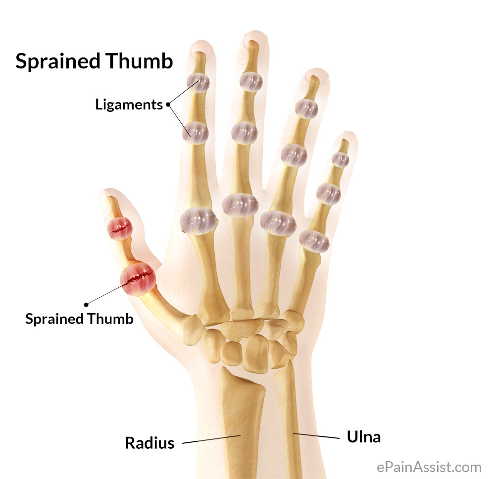 Thumb Pain Causes Symptoms Treatment Diagnosis