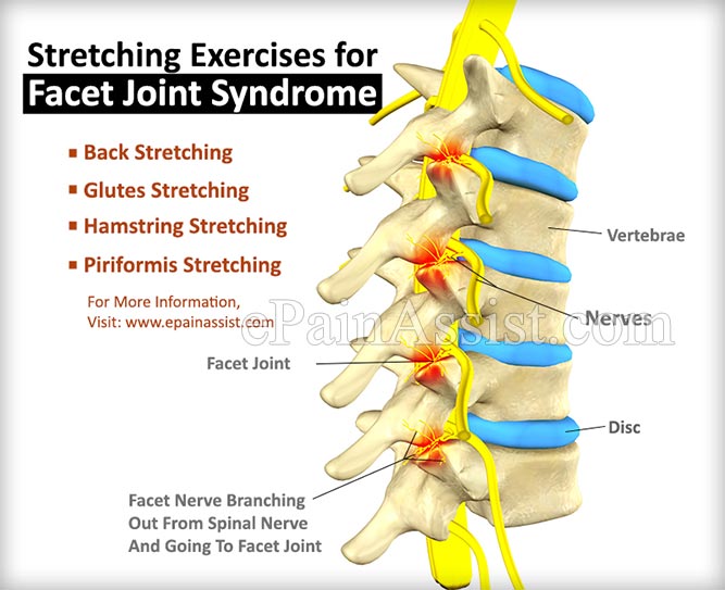 Stretching Exercises for Facet Joint Syndrome