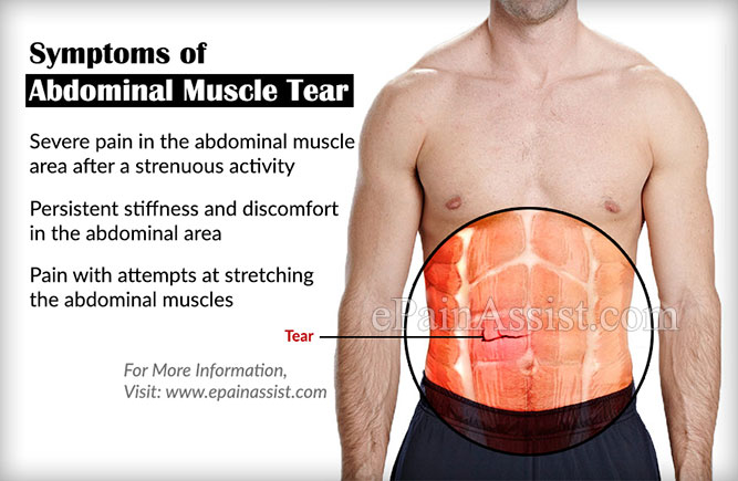 Muscular Tear 24