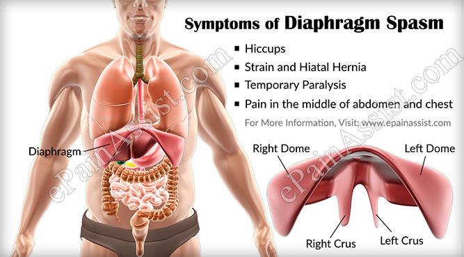 Diaphragm Spasm Symptoms Causes Treatment Epidemiology Complications
