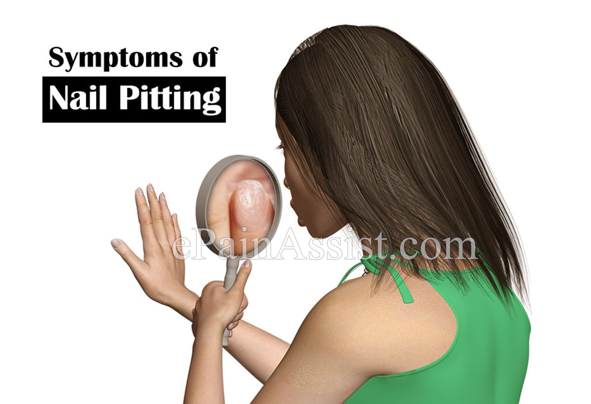 Symptoms of Nail Pitting or Pitted Nails