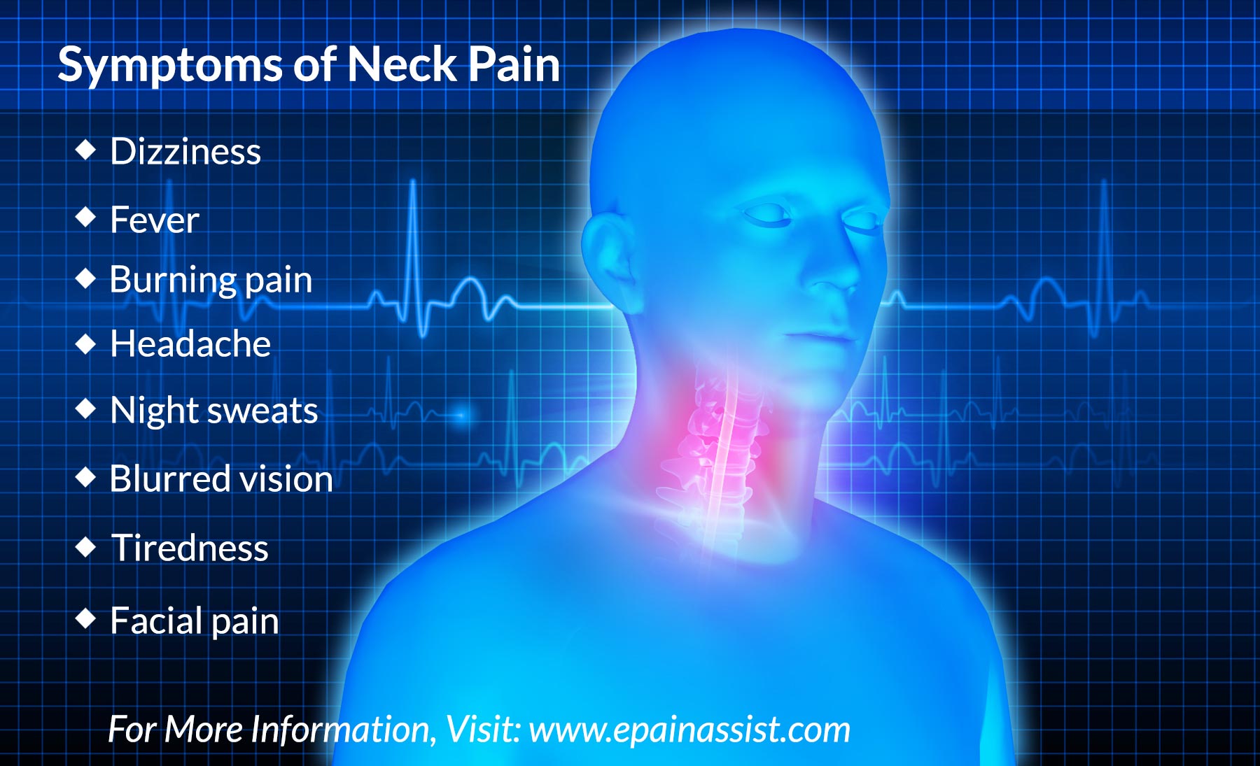 Neck Pain: Symptoms of Neck Pain or Cervicalgia