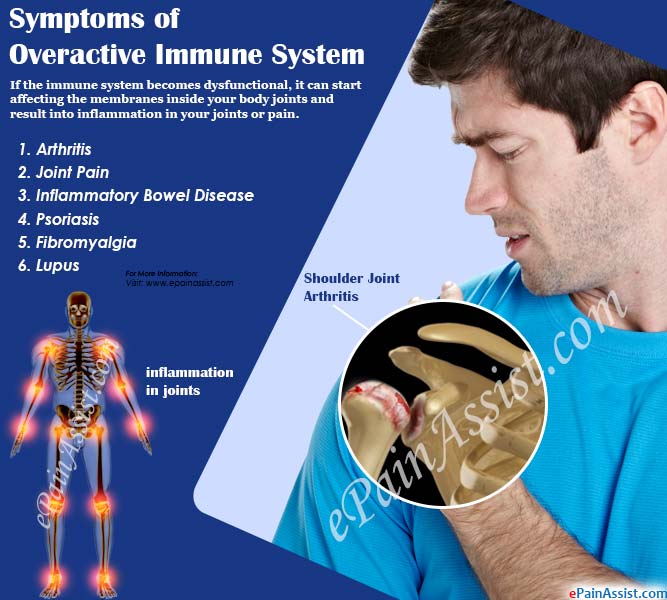 Symptoms of Overactive Immune System