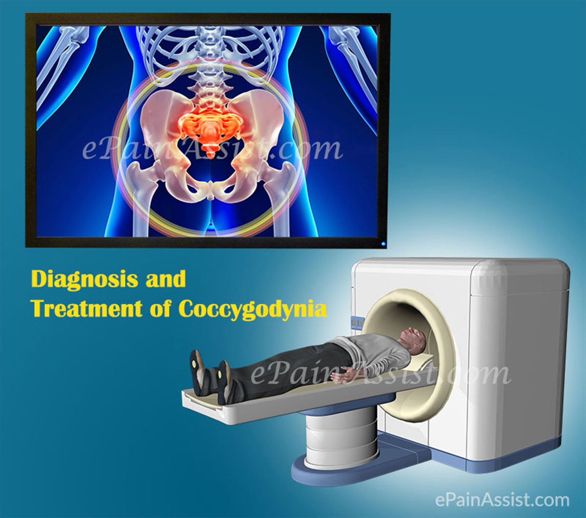 Tests to Diagnose Coccygodynia or Coccygeal Pain