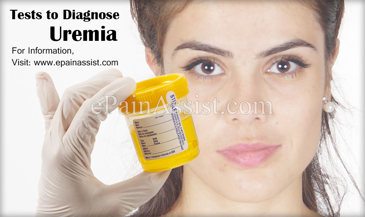Tests to Diagnose Uremia