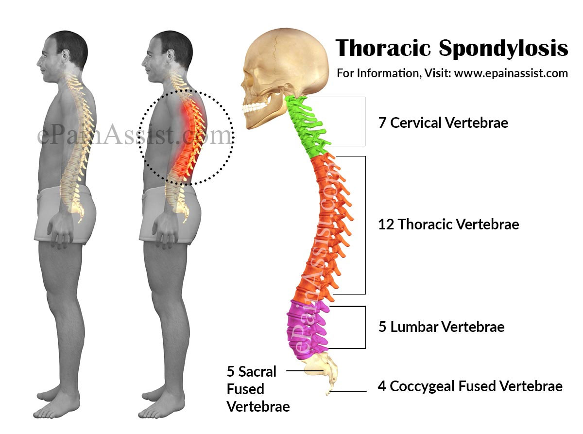 Lumbar Spondylosis Low Back Pain Ayurveda Panchakarma