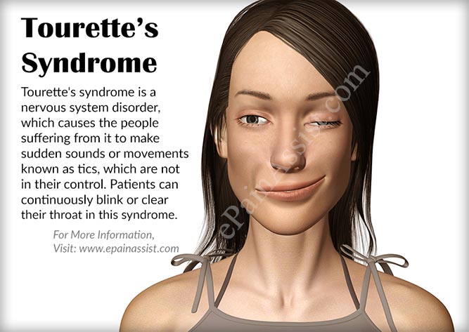 Tourette’s Syndrome