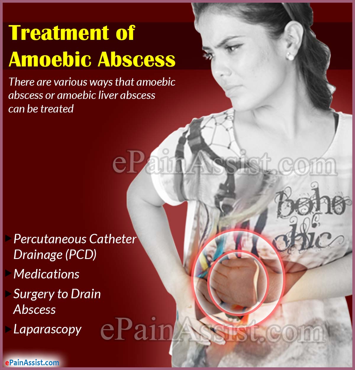 Treatment of Amoebic Abscess or Amoebic Liver Abscess