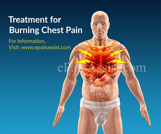 Treatment for Burning Chest Pain