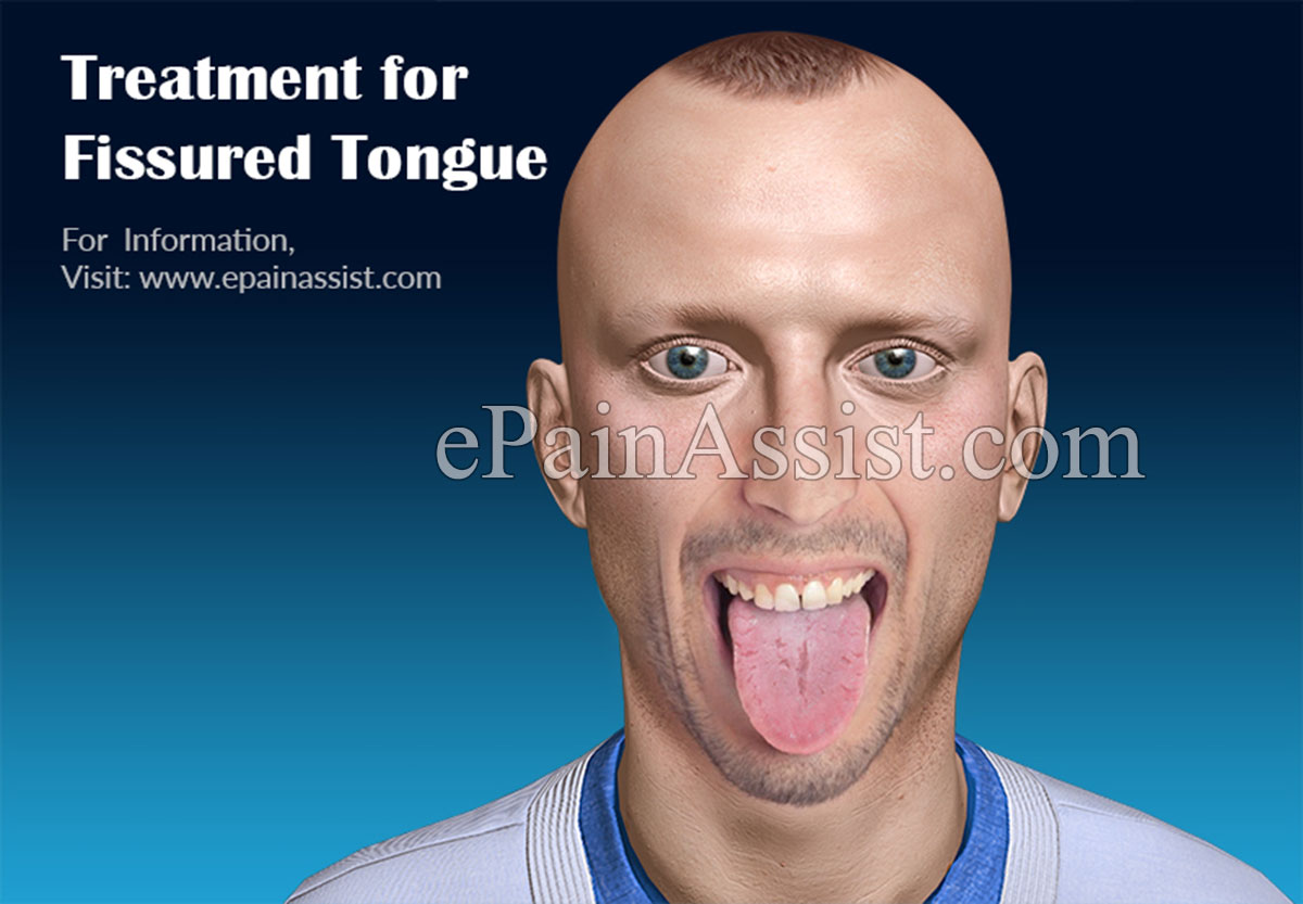 Treatment for Fissured Tongue