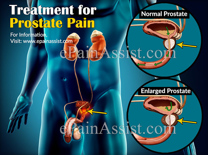 Treatment for Prostate Pain