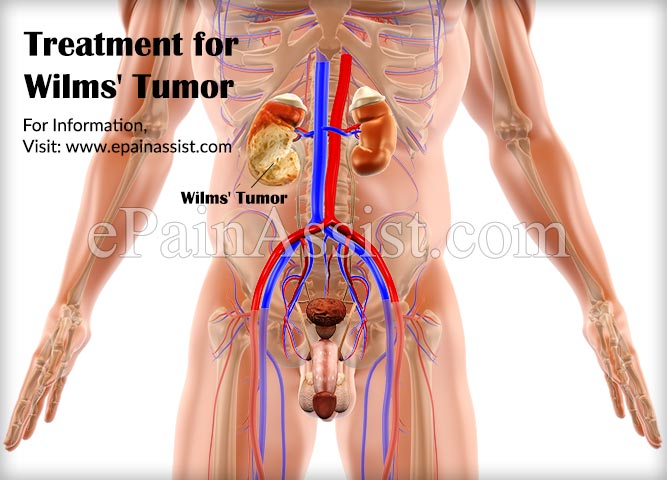 Treatment for Wilms' Tumor