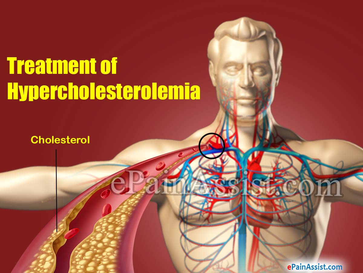 Treatment of Hypercholesterolemia (High Cholesterol) Treatment of Hypercholesterolemia (High Cholesterol)