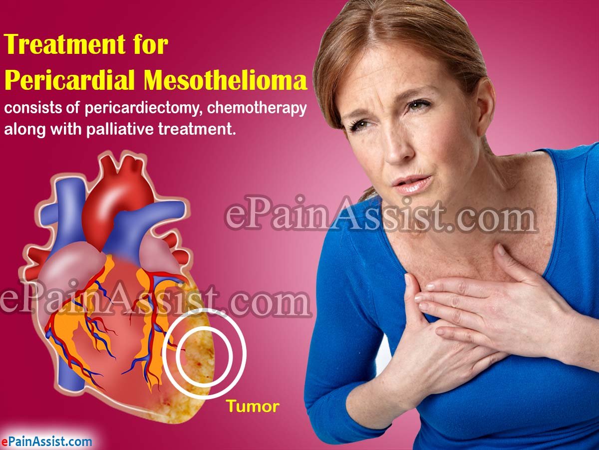Treatment for Pericardial Mesothelioma Treatment for Pericardial Mesothelioma