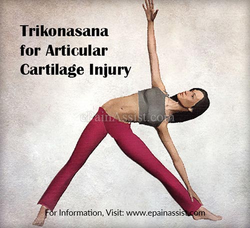 Trikonasana for Articular Cartilage Injury