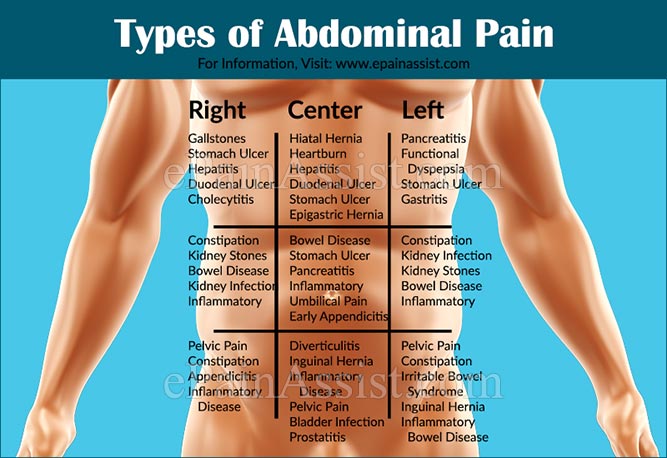 Types of Abdominal Pain or Stomach Ache