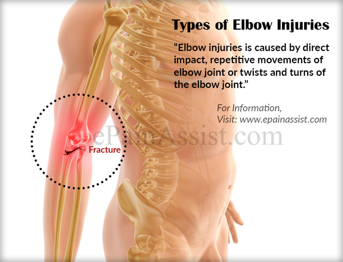 Types of Elbow Injuries