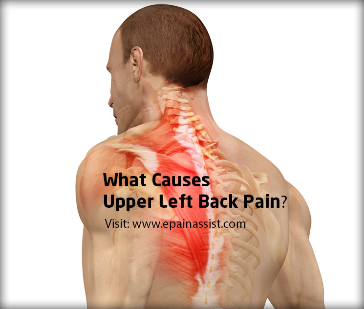 What Causes Upper Left Back Pain?