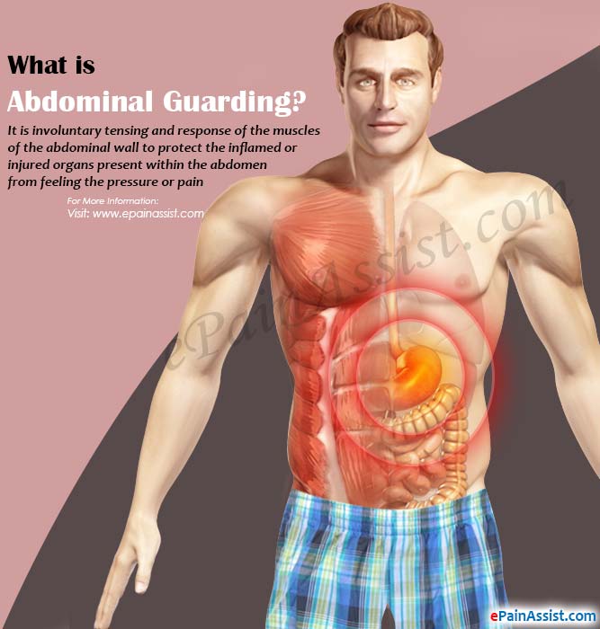 What is Abdominal Guarding?