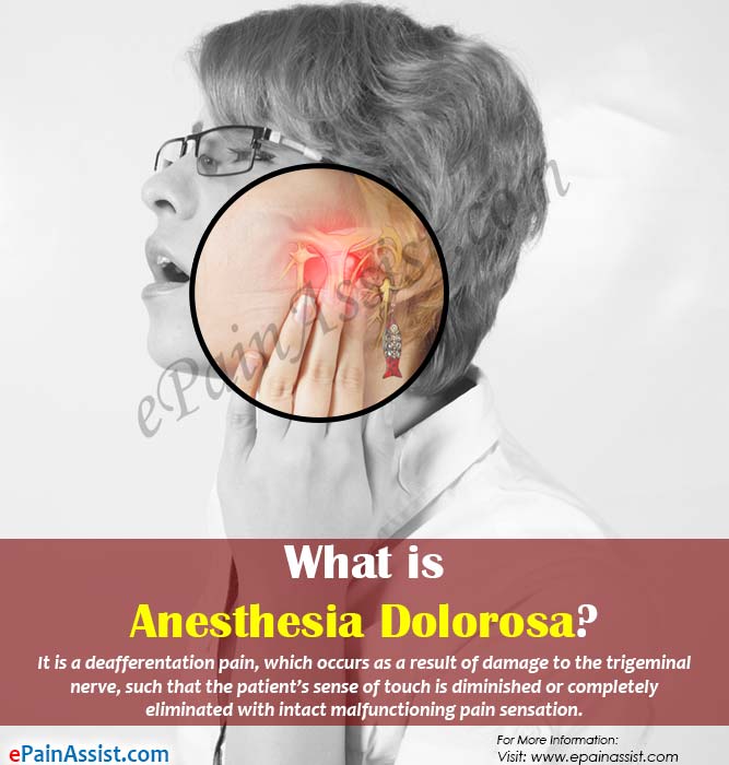 What is Anesthesia Dolorosa?