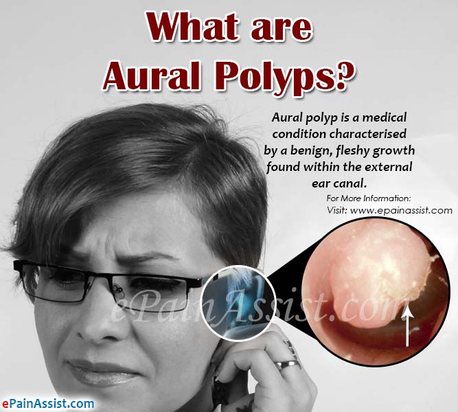 What are Aural Polyps?