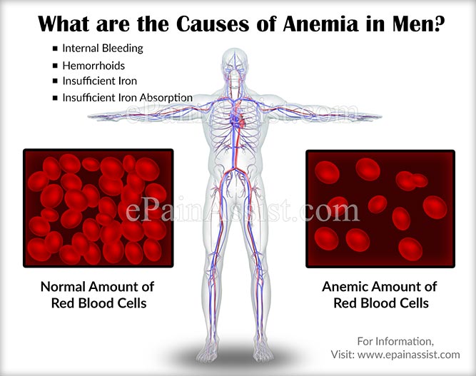 What are the Causes of Anemia in Men?