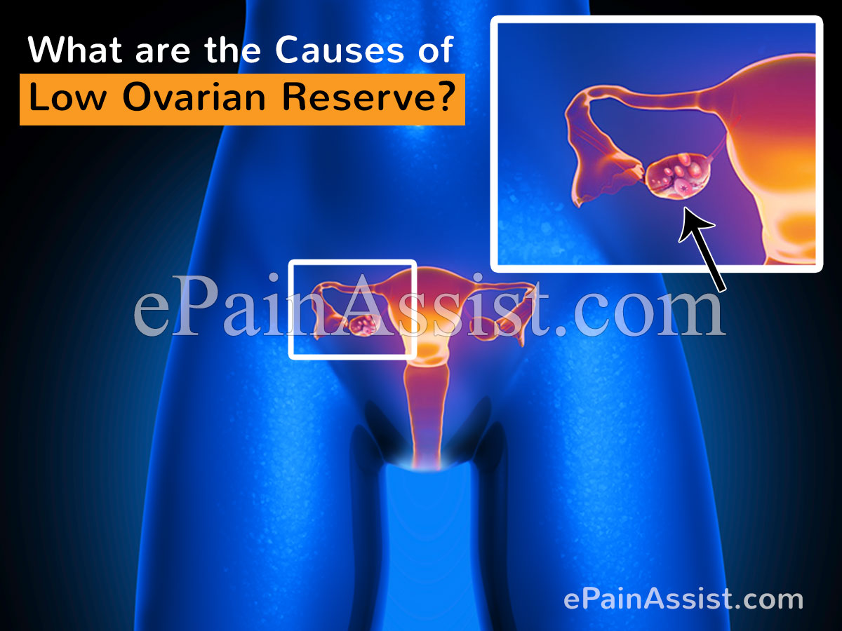What are the Causes of Low Ovarian Reserve?