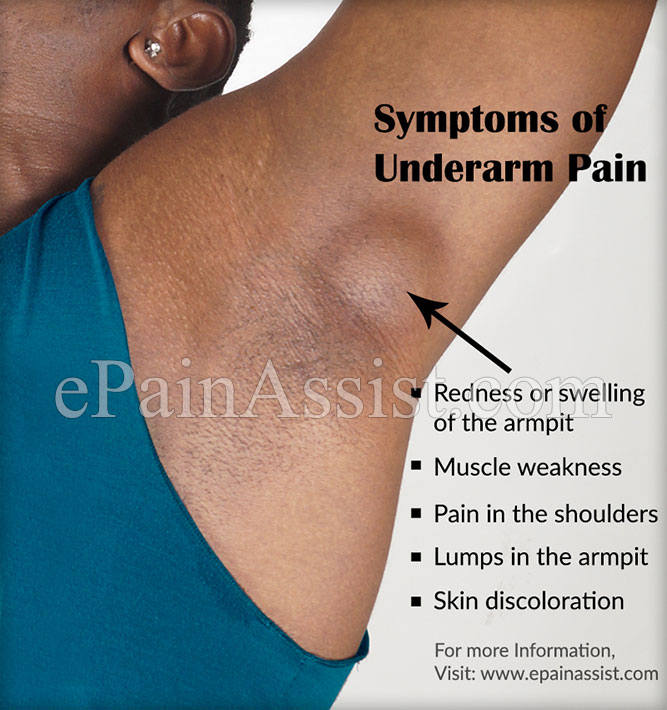 What are the Symptoms of Underarm Pain or Armpit Pain?