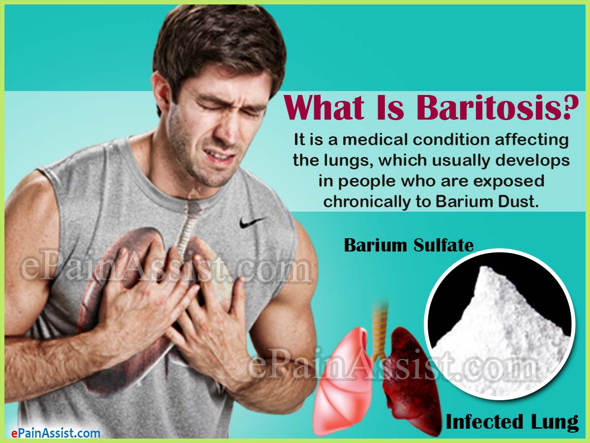 What Is Baritosis?