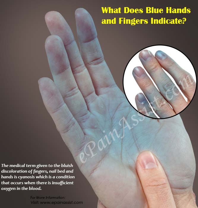 What Blue Hands Fingers Indicate & What its Causes?