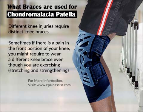 What Braces are used for Chondromalacia Patella (CMP)?