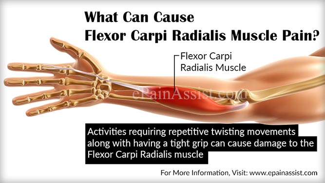 What Can Cause Flexor Carpi Radialis Muscle Pain?