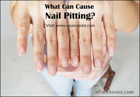 What Can Cause Nail Pitting or Pitted Nails?