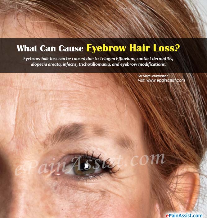 eyebrow hair loss